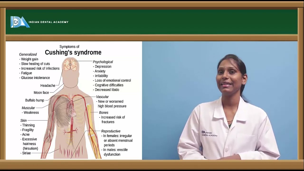 Cushing's syndrome | General Medicine for Dentists | #NEET#MDS#BDS#NBDE#ORE#DDS