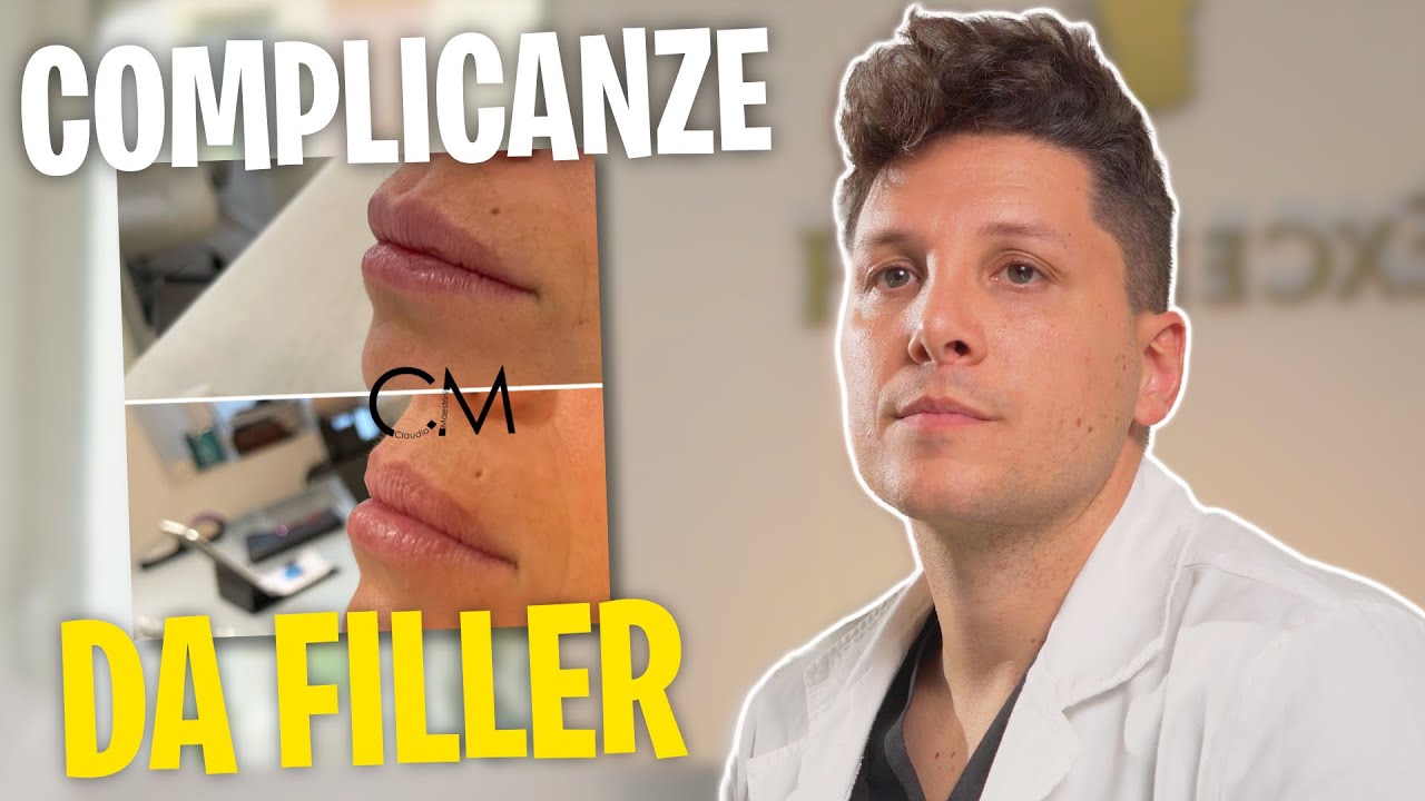 IALURONIDASI: Cos'è? Effetti, Rischi e Complicanze da Filler | Dr. Claudio Maestrini