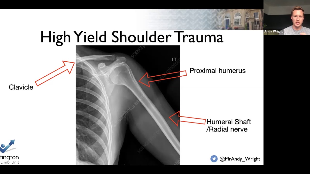 Shoulder FRCS (orth) revision Wrightington w BOTA
