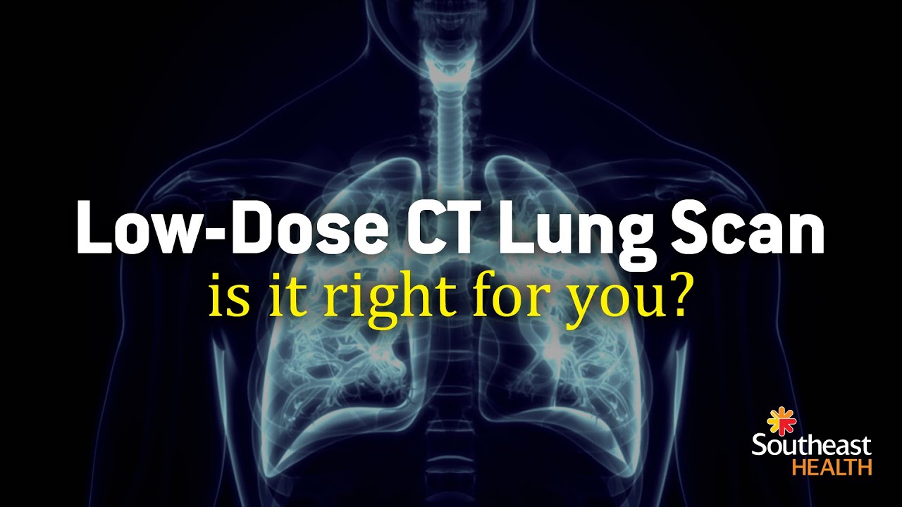 Is A Low-Dose CT Scan Right For You?