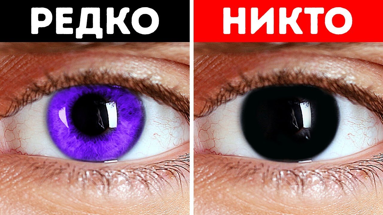 Почему у людей нет фиолетовых глаз? + другие факты о теле!