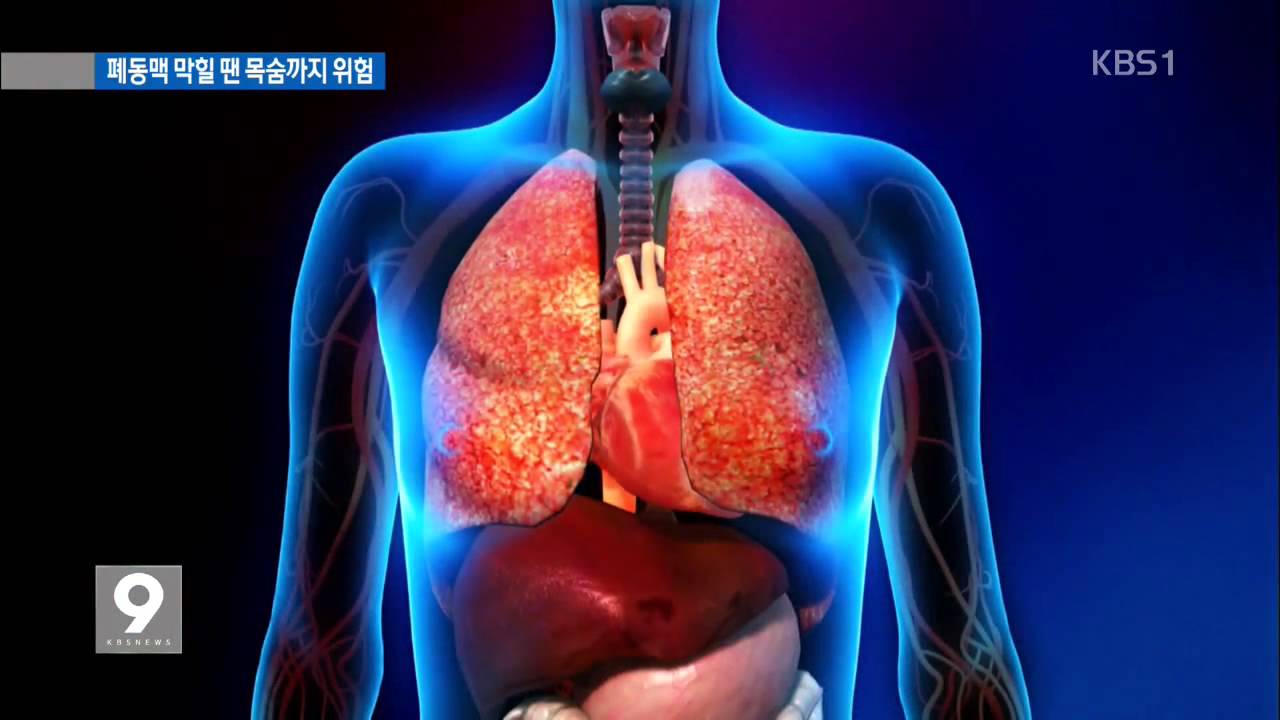 겨울철 &lsquo;다리 혈전&rsquo; 주의&hellip;자칫 목숨까지 위험