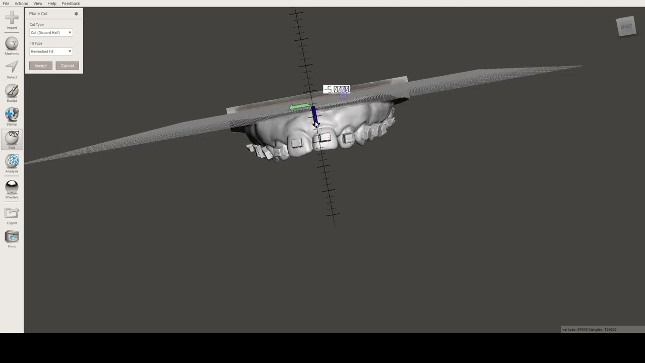 How to edit digital models for resin 3D printing using meshmixer
