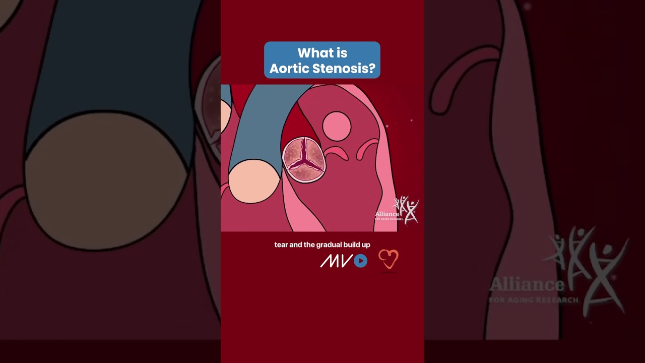 What is Aortic Stenosis? 🤔🫀