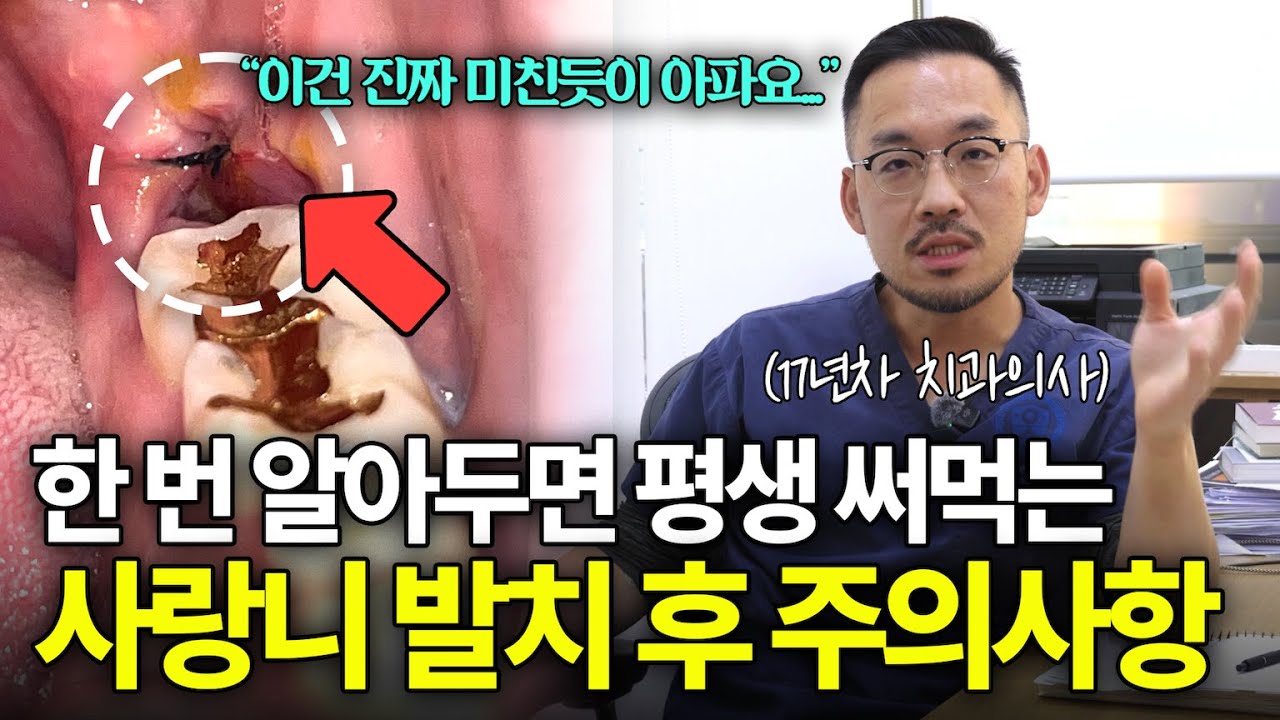 사랑니 발치 주의사항 통증, 지혈 핵심만 알려드립니다 l 발치 후 병원에 가야 하는 상황까지 총정리