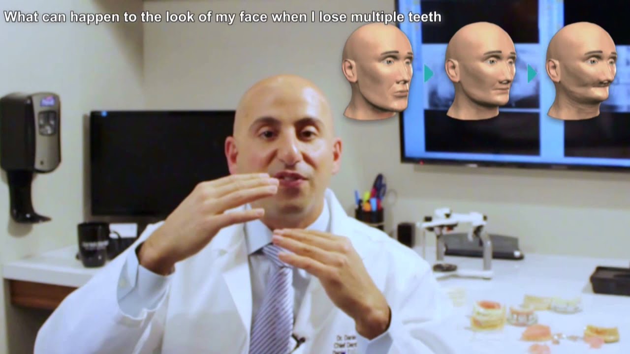 What can happen to the look of my face when I lose multiple teeth?