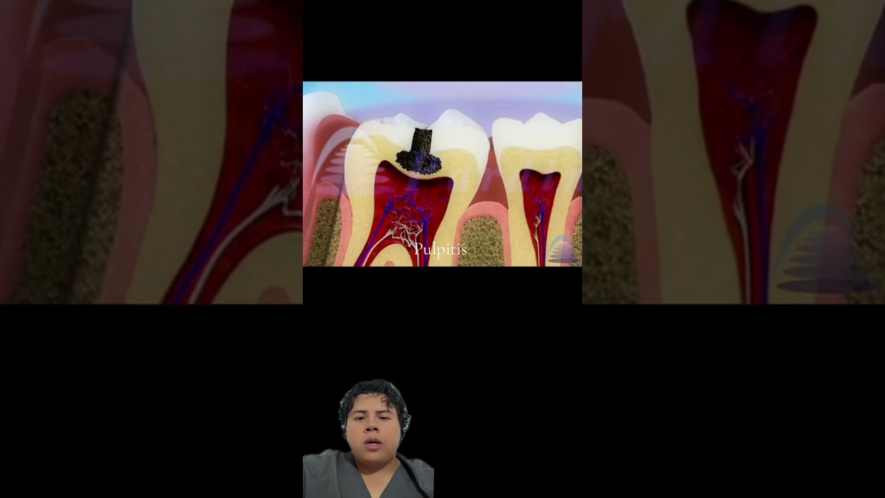 Inflamación Patología General #DrOlacio