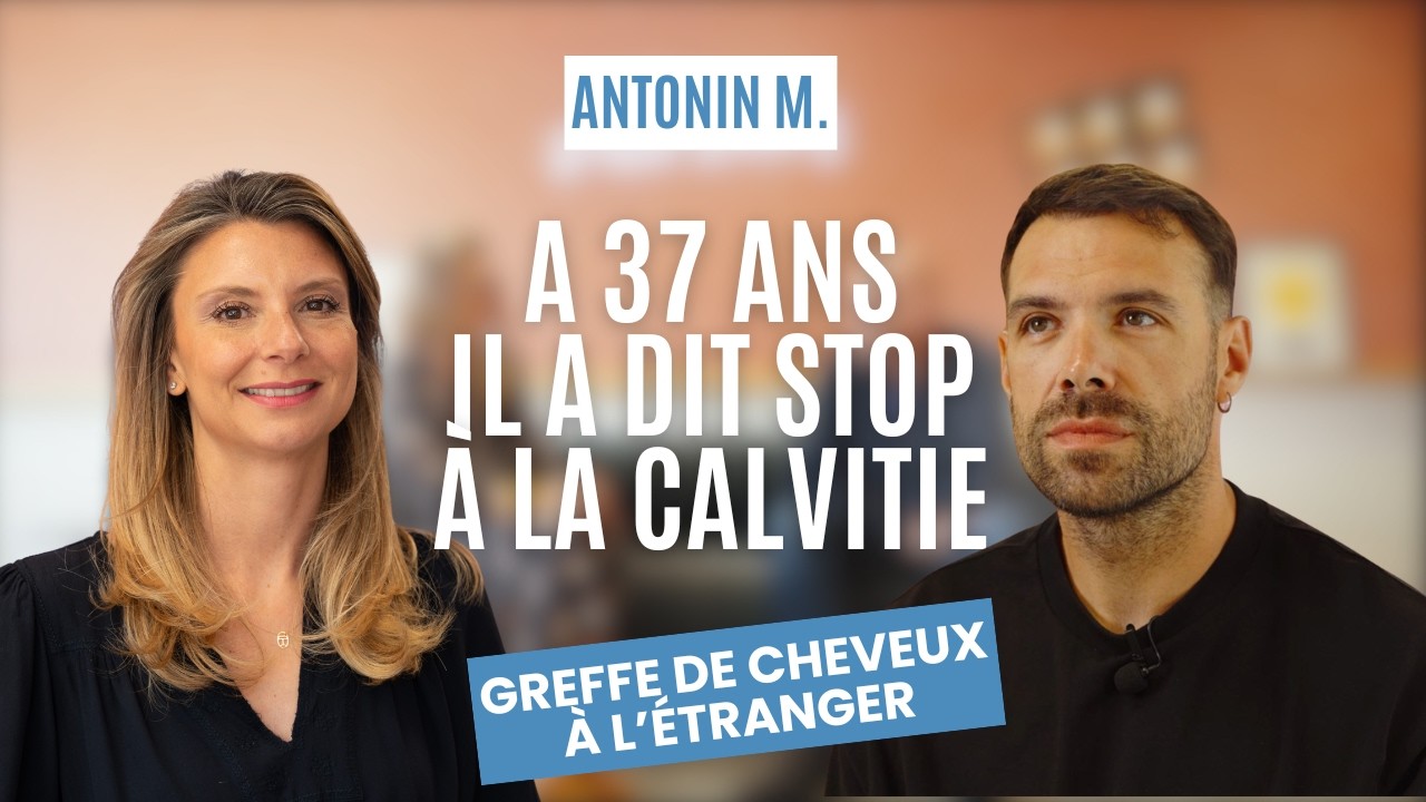 Greffe de cheveux en Hongrie avec Smile Partner, il témoigne !