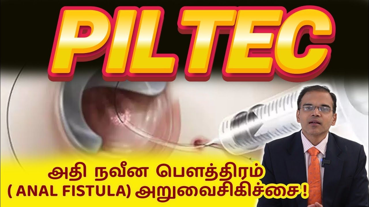 அதி நவீன பௌத்திரம் ( ANAL FISTULA) அறுவைசிகிச்சை ! PILTEC