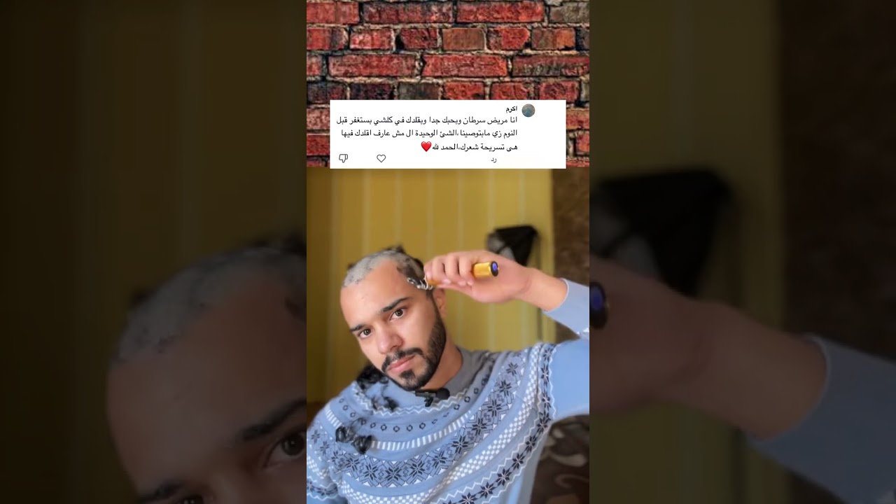 د.احمد اشرف يحلق شعره امام الكاميرا تعاطف مع مريض السرطان