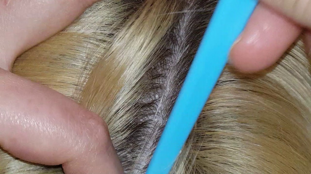 Dandruff scalp scratching picking with comb & fingernails on my son ASMR hair little talking