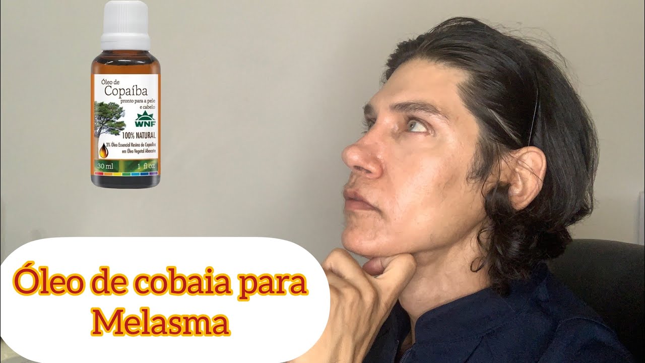 Óleo de copaíba para melasma será? #MK123