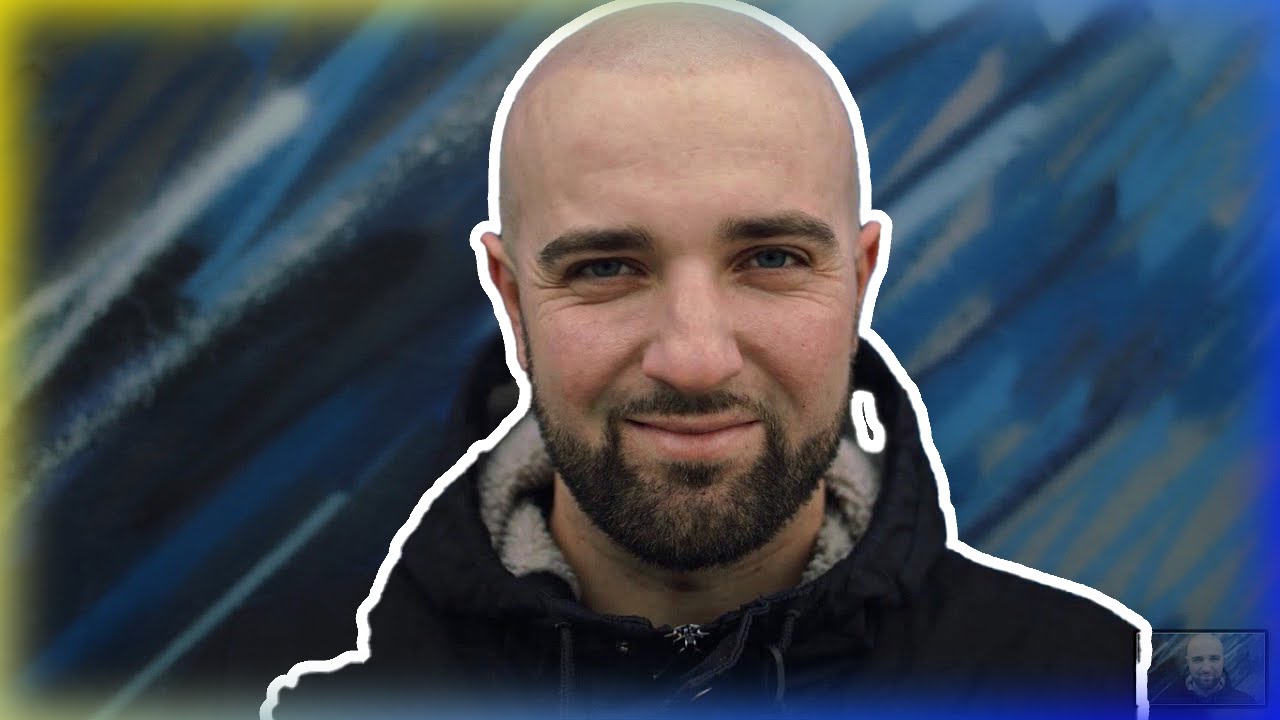 Scalp Micro Pigmentation London - Westminster Medical Group