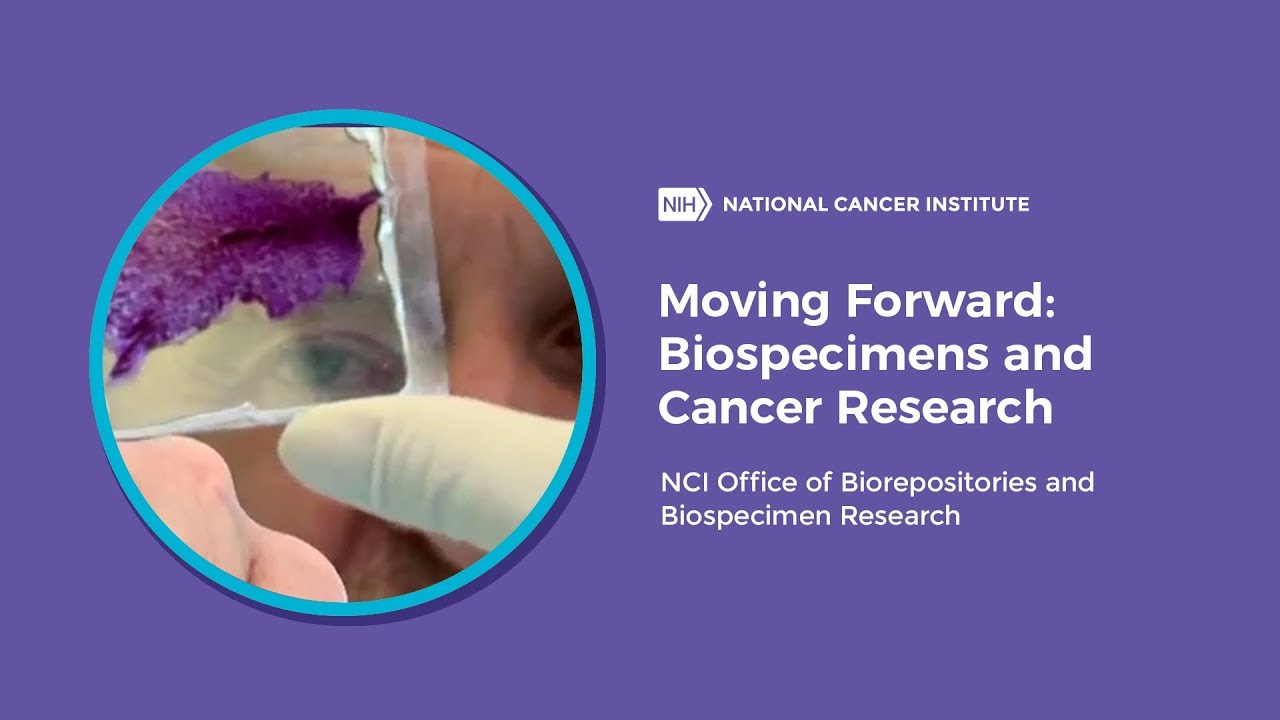 Moving Forward: Biospecimens and Cancer Research