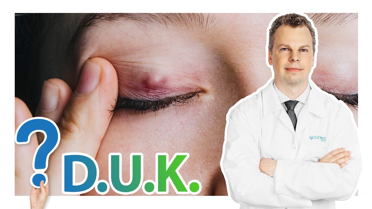 D.U.K. apie akių miežį | Med.m.dr. Jurgis Trumpaitis
