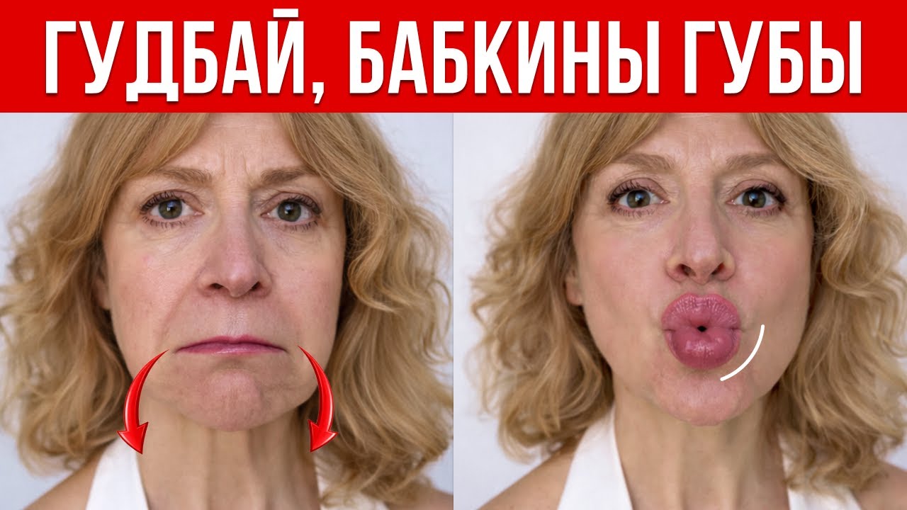 Губы-ниточки стали ПУХЛЫМИ, уголки  ПОДНЯЛИСЬ, МОРЩИНЫ губ ушли! Результат за 7 дней! Без филлеров