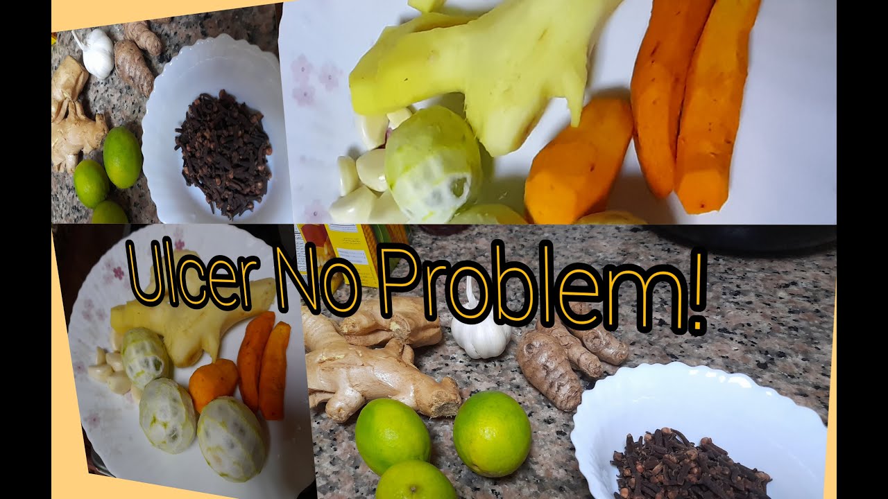 Cure Ulcer in 3 Days Naturally | Gwapa Ko