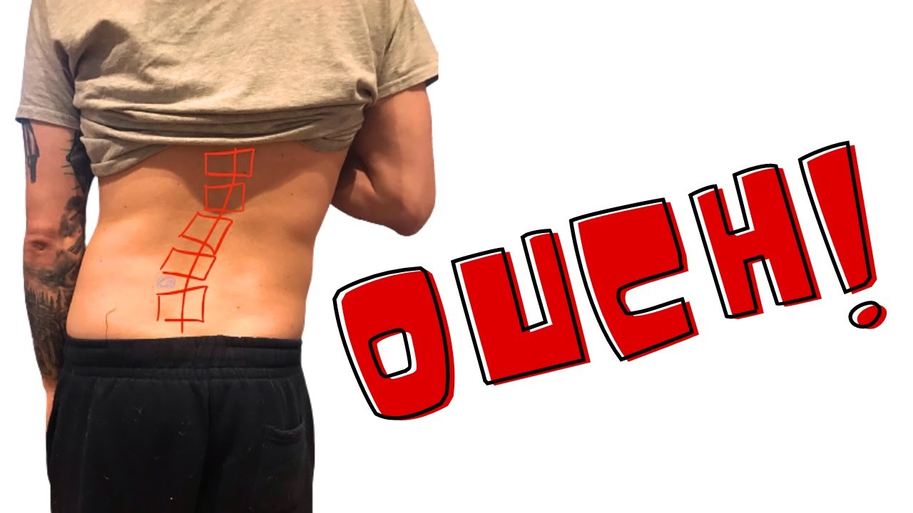 Watch This BEFORE Correcting Your Crooked Back!