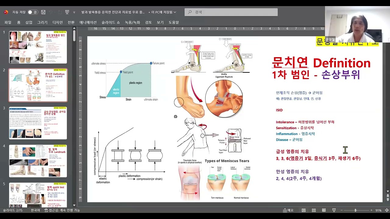 발 통증 흔한 통증 쉽게 찾고, 즉석에서 50%이상 통증 치료하는 법