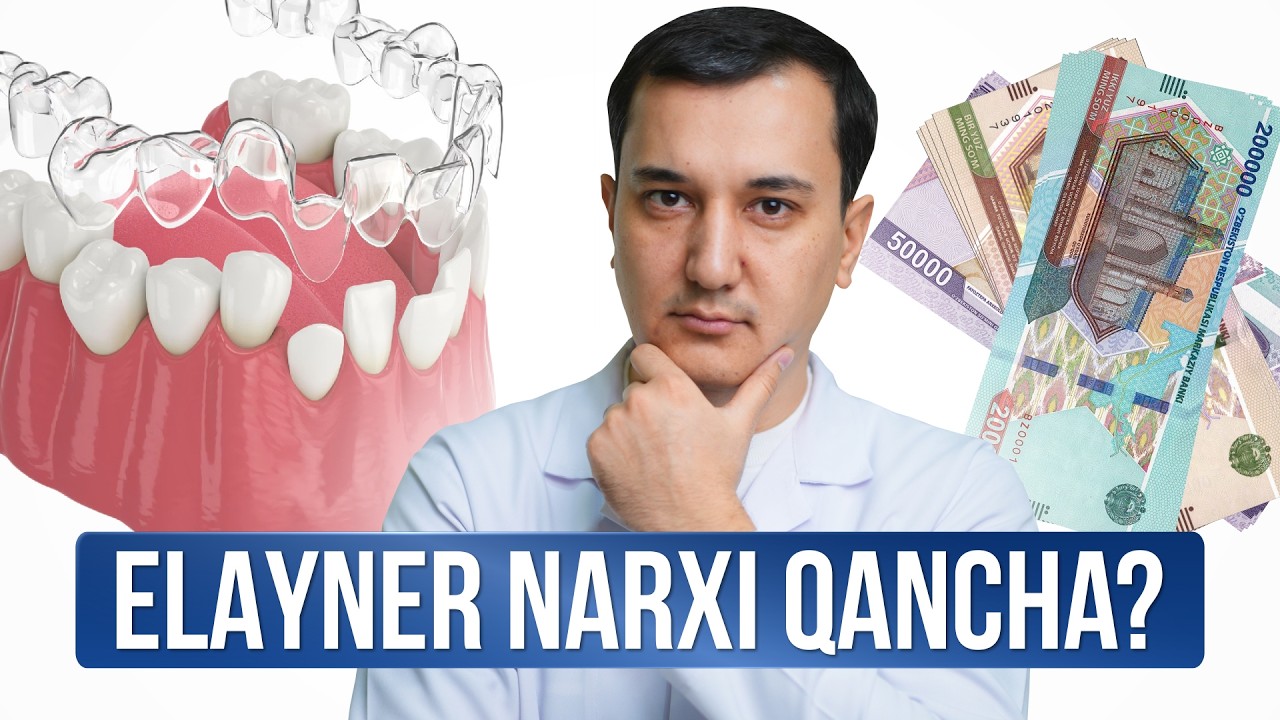 Elayner narxi qancha? Kimlar taqsa bo'ladi