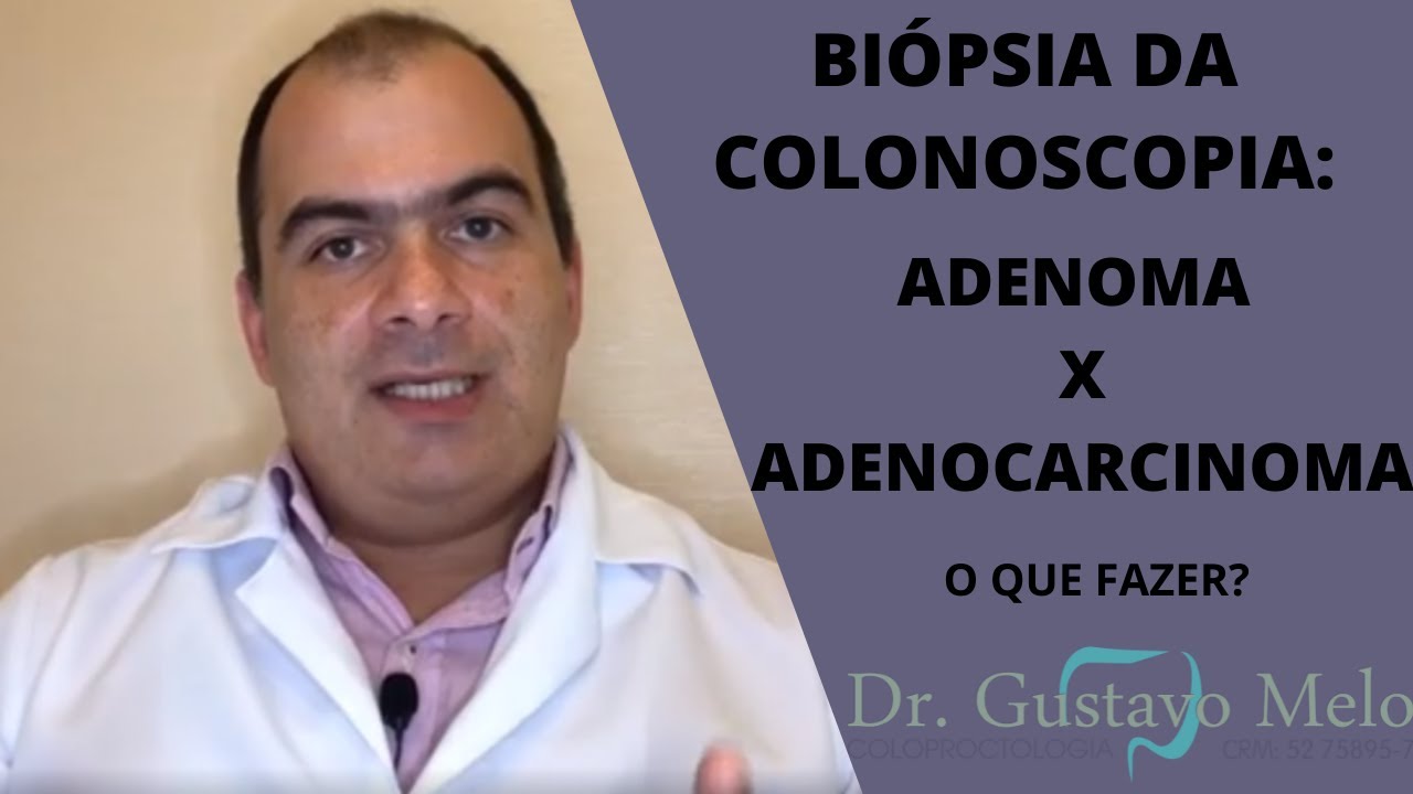 Biópsia da colonoscopia: Adenoma x Adenocarcinoma.