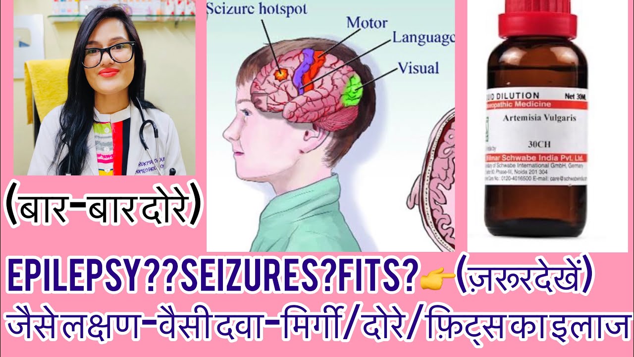 एपलेप्सी ?मिर्गी दोरे का इलाज?homeopathy  For fits |Epilepsy homeopathic medicine-Dr.rukmani