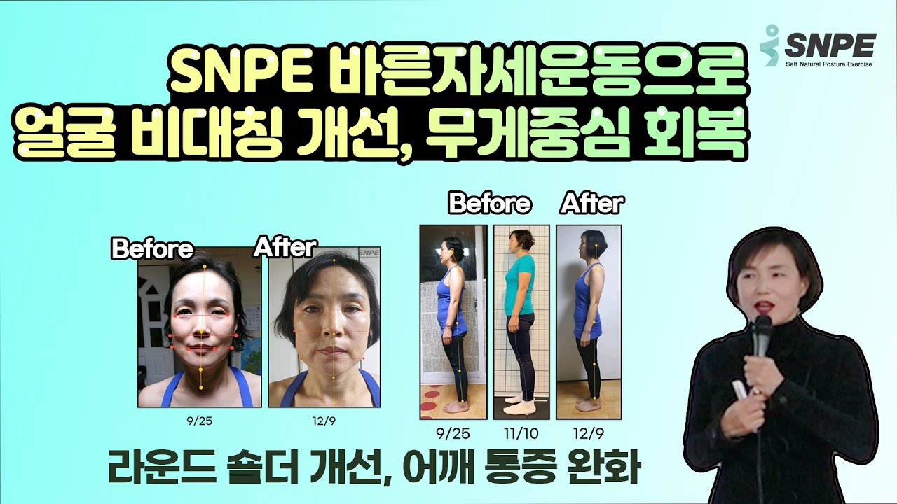 SNPE 운동으로 전신 부종과 무릎 통증이 완화됐어요! +체형교정까지!