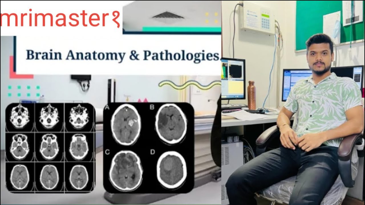 NCCT brain Anatomy & pathology | NCCT brain by Pawan Kumar