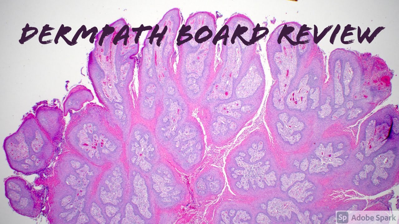 Dermatopathology Board Review for Dermatology Pathology Dermpath (19 Classic Cases)