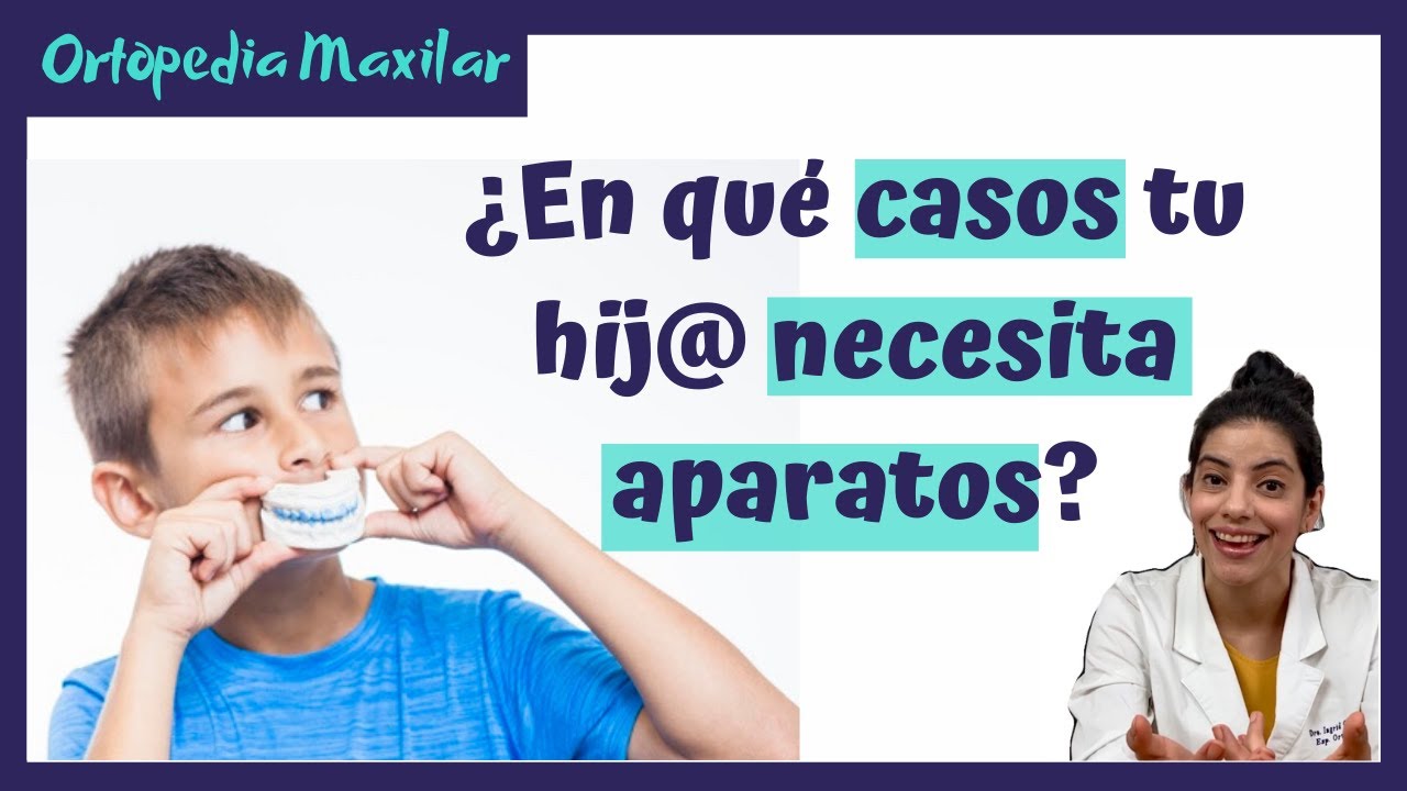 👉🏼¿¿En que casos tu hijo necesita aparatos??