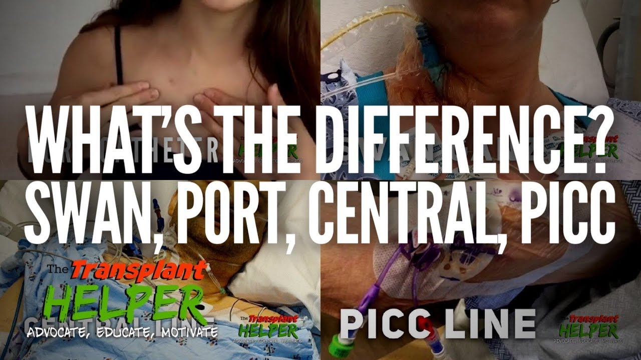 Swan Ganz, Port, Central и PICC. В чем разница?