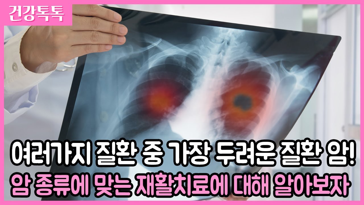 다양한 신체부위에 발생할 수 있는 암, 암의 종류에 따른 재활치료에 대해 제대로 알고 생존률 높여보자! - 건강톡톡 201127 아침이 좋다