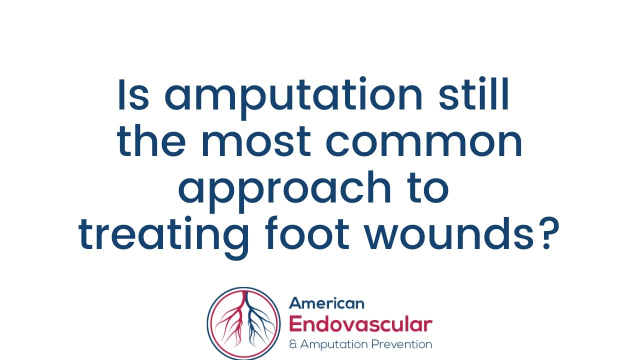 Is amputation still the most common approach to treating severe Peripheral Artery Disease?