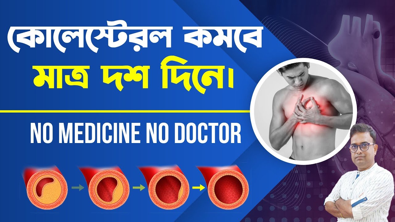 Most effective way to lower cholesterol very fast without medicine . কোলেস্টেরল কম করার ঘরোয়া উপায়।