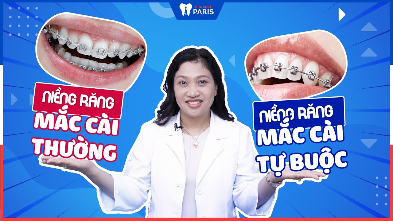 Nên dùng mắc cài kim loại thường hay tự buộc