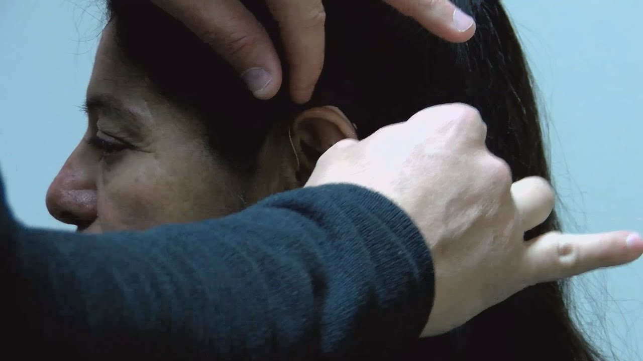 New tech restores Odessan&rsquo;s hearing, hope for single-sided deafness