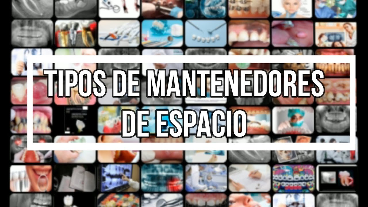 TIPOS de MANTENEDORES de ESPACIO. CLASIFICACI&Oacute;N, ZAPATILLA DISTAL, BARRA TRANSPALATINA...