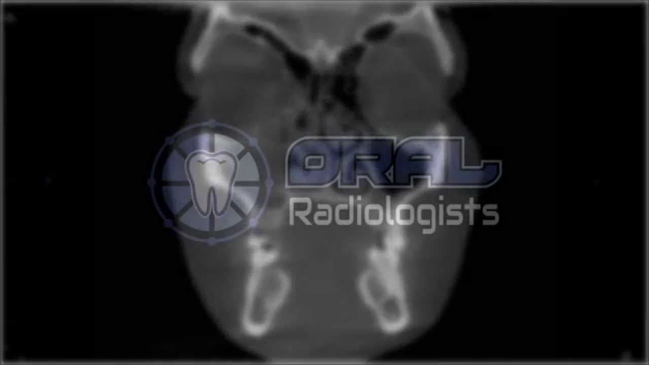 Cone Beam CT Common Finding and Anatomy Intro