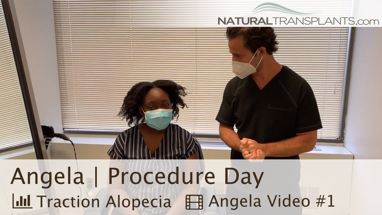 Traction Alopecia Hair Transplant for Female | Dr Kevin Blumenthal (Angela)
