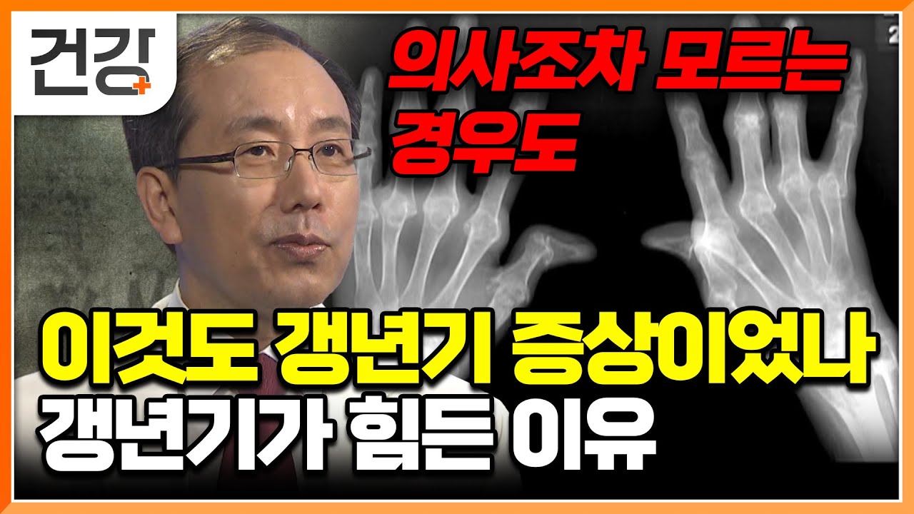 “갱년기가 이렇게까지 힘든 줄 몰랐어요” 몸이 보내는 이상 신호, 그냥 넘기지 마세요│명의│#EBS건강