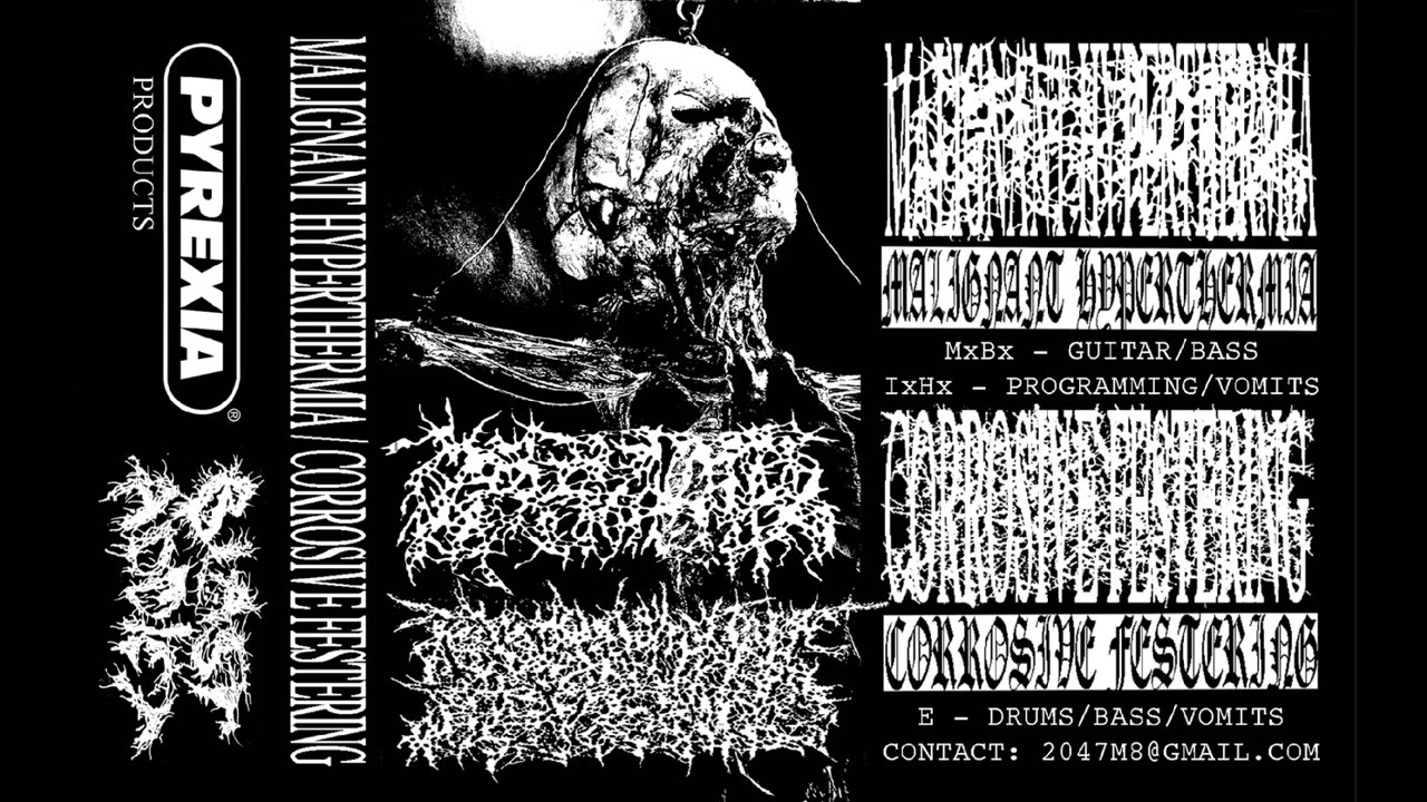 MALIGNANT HYPERTHERMIA/CORROSIVE FESTERING - FULL SPLIT