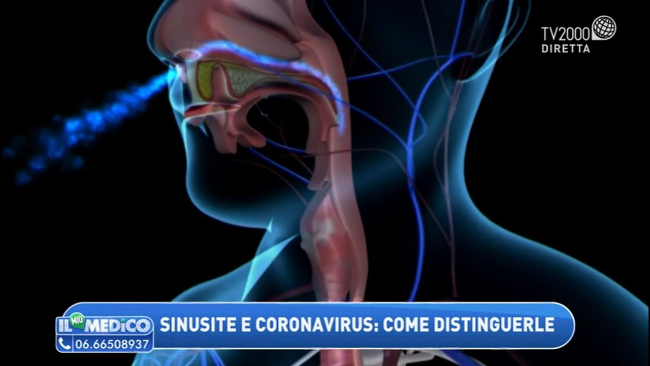Tutto sulla sinusite. Ecco come curarla