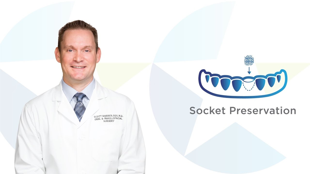 Socket Preservation in Waco TX | Brazos Oral & Facial Surgery