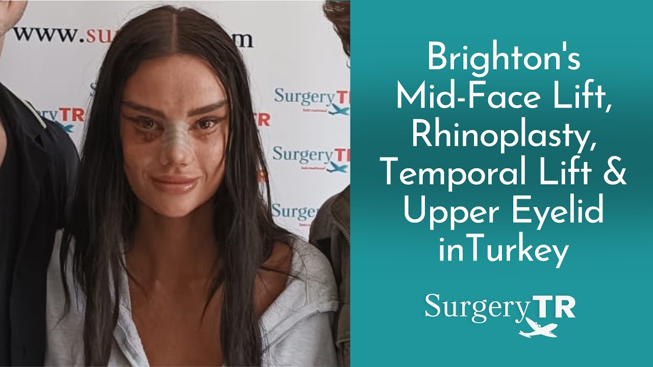 Mid-Face Lift, Rhinoplasty, Temporal Lift, and Upper Eyelid | Brighton's Experiences | SurgeryTR