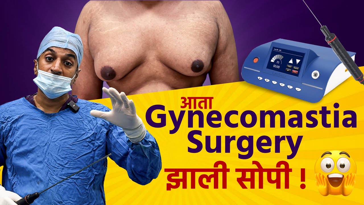 आता Gynecomastia Surgery झाली सोपी! | पुरुषांमधील स्तनवाढीवर आधुनिक उपचार | Dr. Neeraj Bhaban