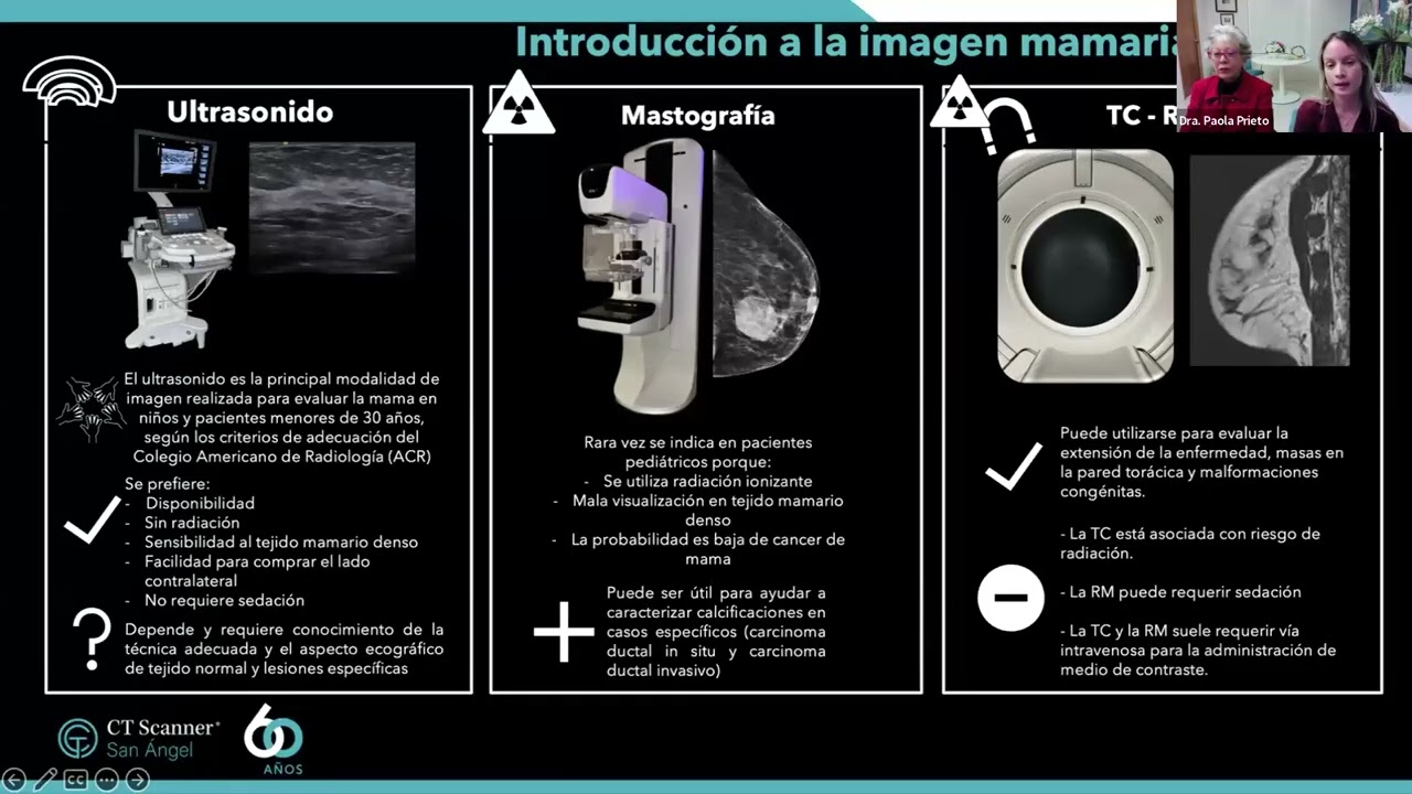 Sesión mensual de la Unidad de Imagen Mamaria, revisión de casos impartido por CT Scanner San Ángel.