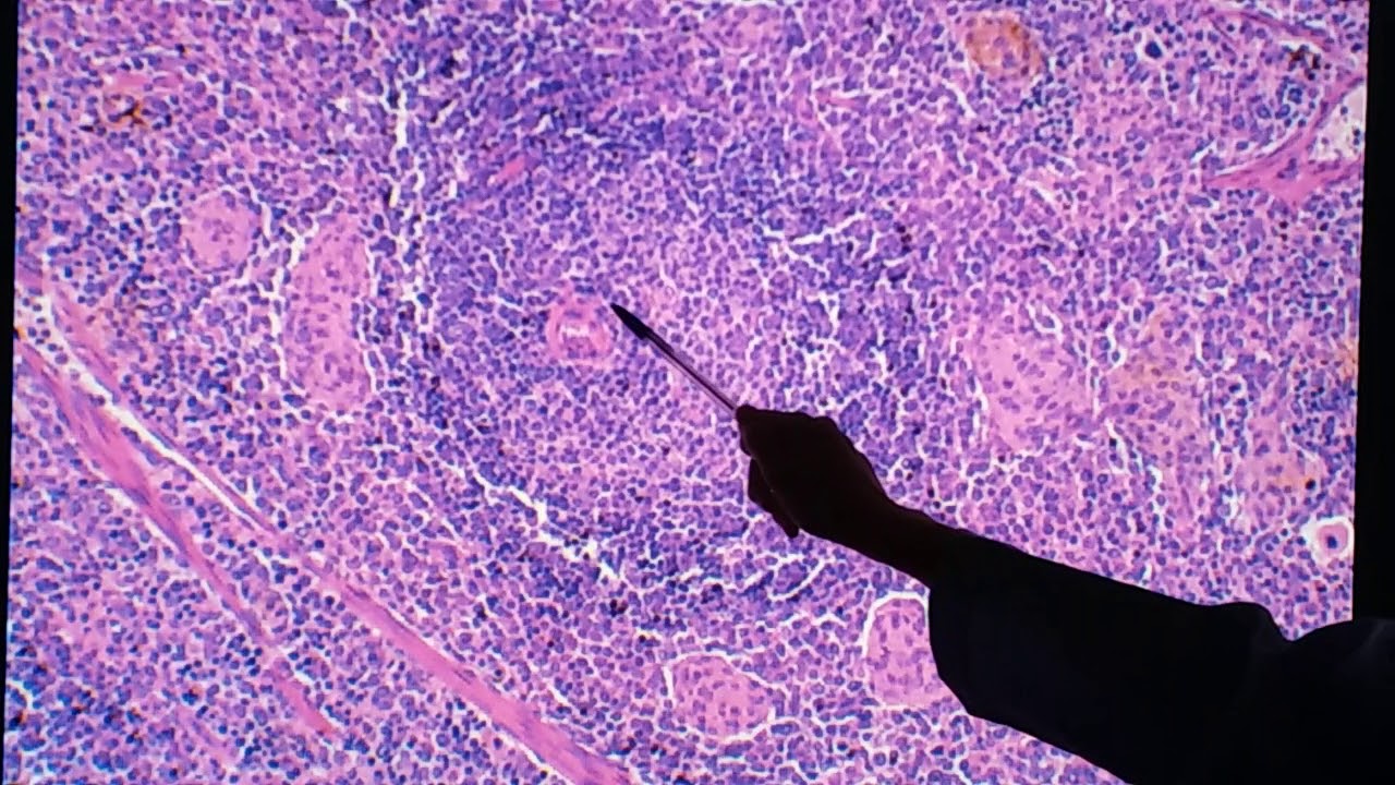 Histologia do baço