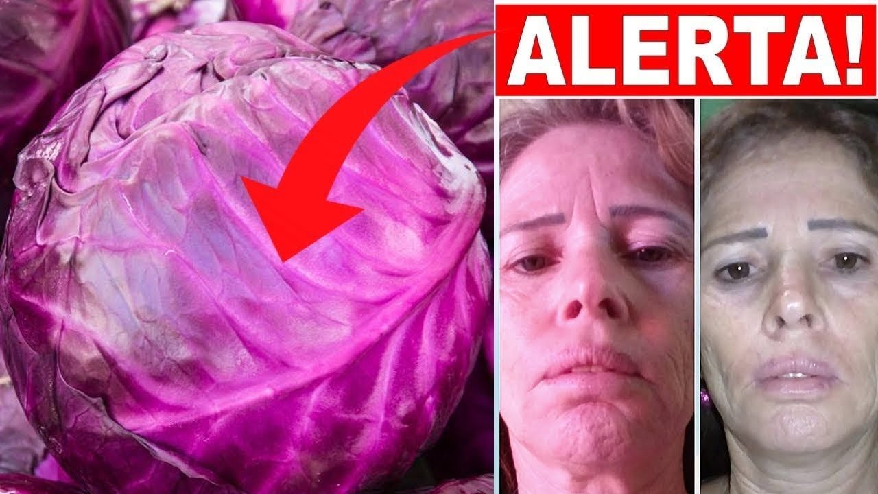 Repolho &eacute; bom para Pele? | Assista esse v&iacute;deo e veja!