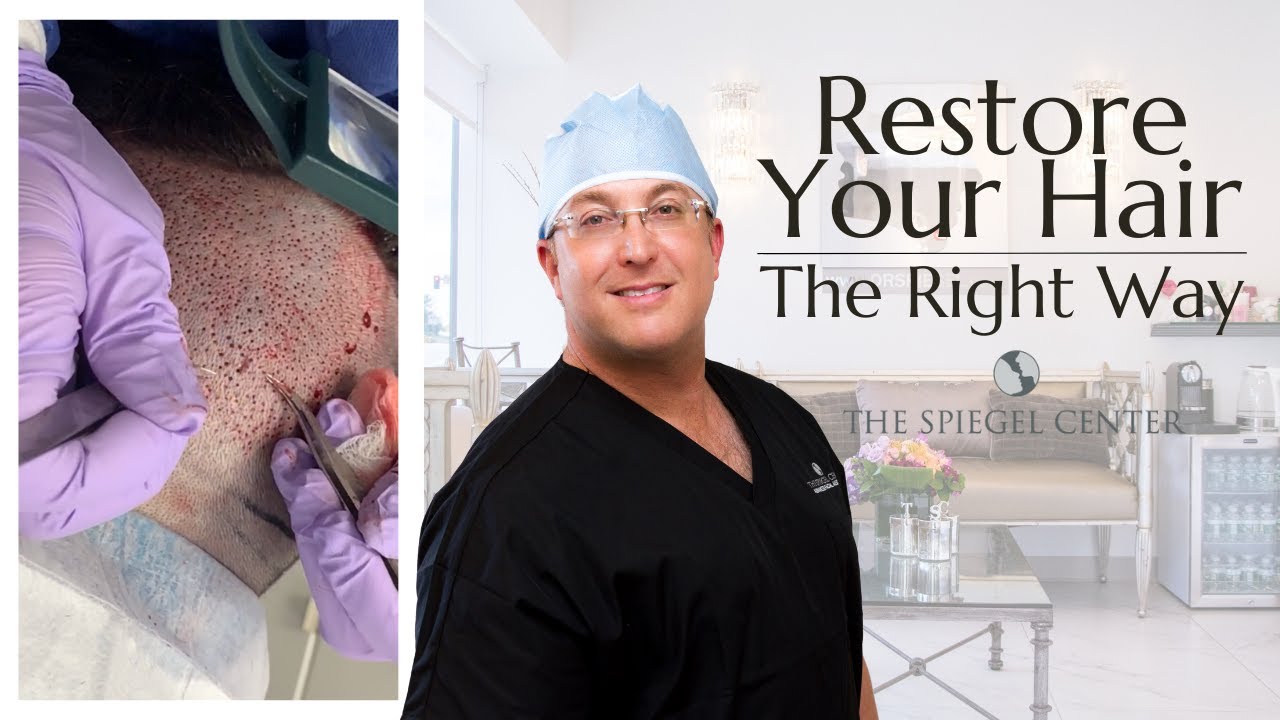 Hair Restoration The Right Way