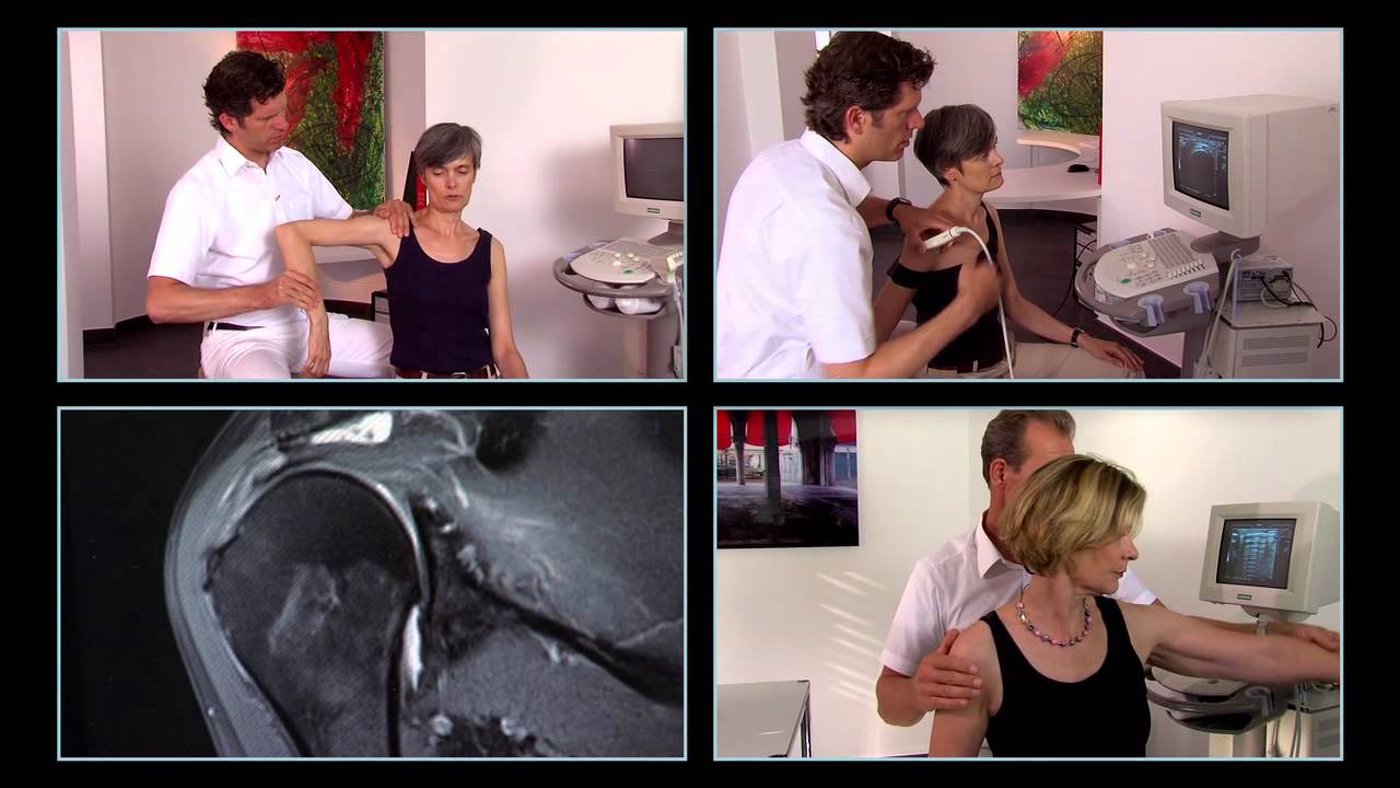 Schulter Schultersteife Capsulitis